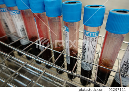 血液檢體 93297111