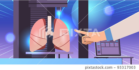 researcher hand pointing lungs model printed on 3d bio printer medical printing of human transplantation organ researcher hand pointing lungs model printed on 3d bio printer medical printing of human transplantation organ 93317003