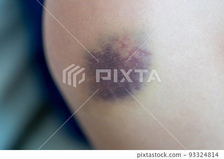 knee, lap, knees 93324814