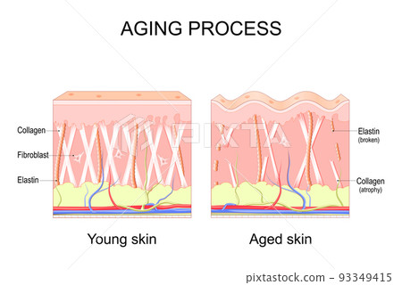Aging process. comparison of Young and aged skin. Collagen, Elastin and fibroblasts Aging process. comparison of Young and aged skin. Collagen, Elastin and fibroblasts 93349415