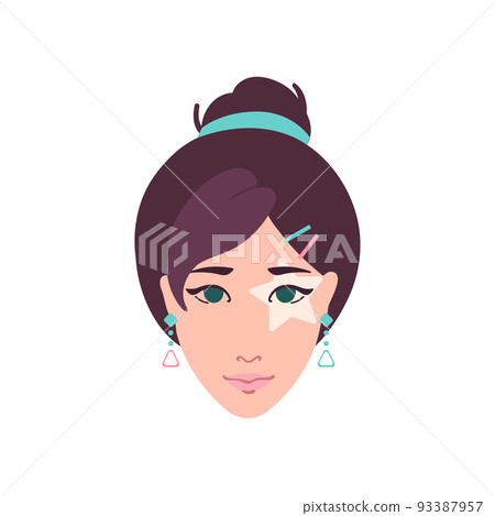 Vitiligo eye patch on caucasian woman face 93387957