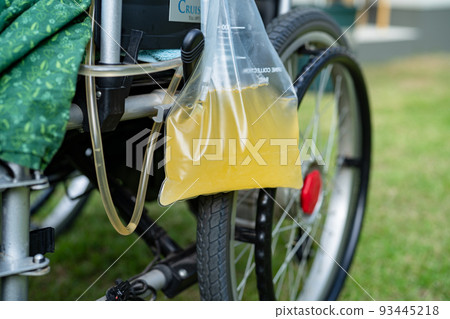 Asian lady woman patient sitting on wheelchair with urine bag in the hospital ward, healthy medical concept Asian lady woman patient sitting on wheelchair with urine bag in the hospital ward, healthy medical concept 93445218