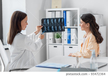 doctor showing x-ray image to woman at hospital doctor showing x-ray image to woman at hospital 93472364