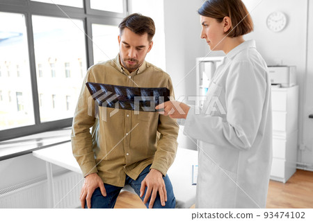 doctor showing x-ray to male patient at hospital 93474102