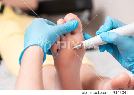 Chiropodist in blue medical goves does hardware peeling of the skin of the female smooth foot. Close-up. The concept of professional pedicure and podology 93480403