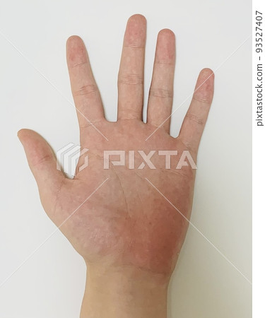 hand  93527407