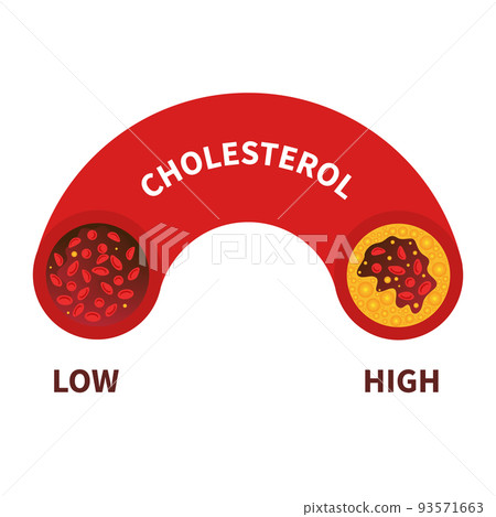 Cholesterol level meter gauge with blood vessel diagram 93571663