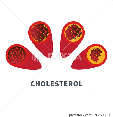 Cholesterol level meter gauge with blood vessel diagram Cholesterol level meter gauge with blood vessel diagram 93571701