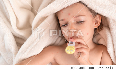 Child with chicken pox lying in bed with Thermometer Child with chicken pox lying in bed with Thermometer 93646314