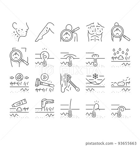Ingrown Hair Problem Treatment Icons Set Vector 93655663
