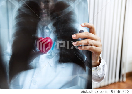 Medical and health care  concept. Doctor holding heart ball and explaining x-ray results to patient while sitting at the table in office. 93661700