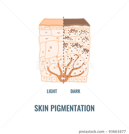 Human skin tone pigmentation diversity infographic diagram 93663877