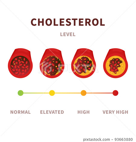 Cholesterol level meter gauge with blood vessel diagram 93663880