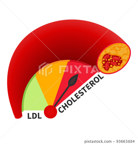 LDL cholesterol level meter gauge with blood vessel diagram LDL cholesterol level meter gauge with blood vessel diagram 93663884