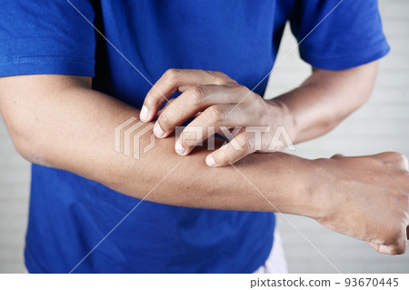 man suffering from itching skin, close up. man suffering from itching skin, close up. 93670445