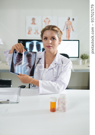 Portrait of young female general practitioner showing lungs x-ray of recovered patient 93702579