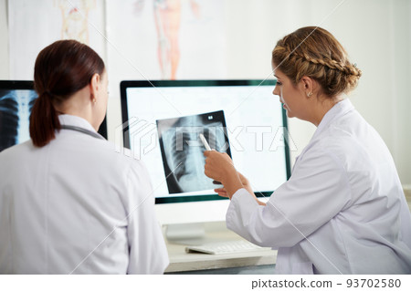 Medical workers analyzing lungs x-rays of patient with coronavirus 93702580