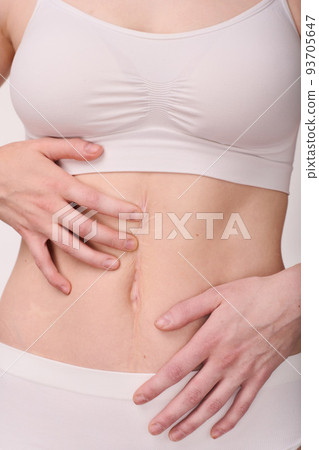 Close-up of young woman in white underwear with slim belly touching scar 93705647