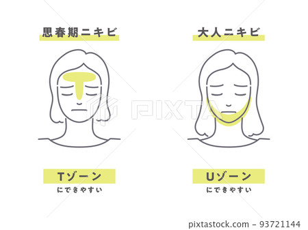 青少年和成人痤瘡 93721144