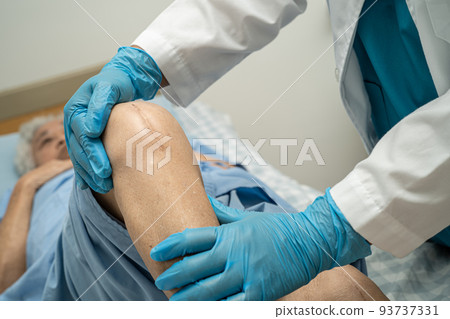 Asian senior or elderly old lady woman patient show her scars surgical total knee joint replacement Suture wound surgery arthroplasty on bed in nursing hospital ward, healthy strong medical concept. 93737331