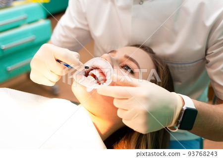 Patient with cheek retractor lies on the dental chair during the procedure teeth whitening 93768243