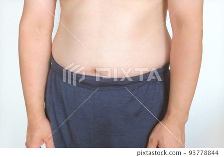 患有代謝綜合徵的男人的腹部 患有代謝綜合徵的男人的腹部 93778844
