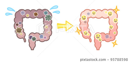 Intestines with good and bad bacteria Intestines with good and bad bacteria 93788598