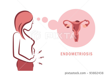 girl with endometriosis and pain womens health anatomy info graphic 93802438