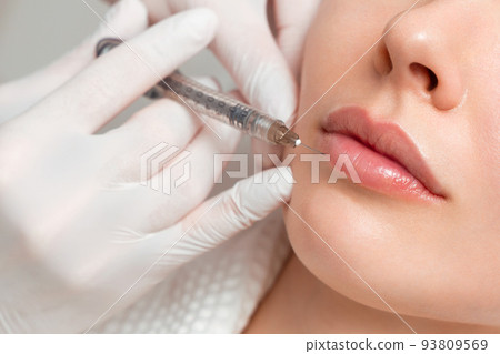 A woman makes lip shape correction in a cosmetology clinic. Lips injections, lip augmentation. 93809569