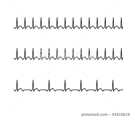 atrial tachycardia 93810628