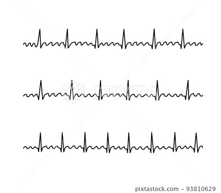 Atrial flutter (AFL) 93810629
