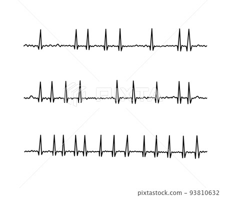 Atrial fibrillation - Stock Illustration [93810632] - PIXTA
