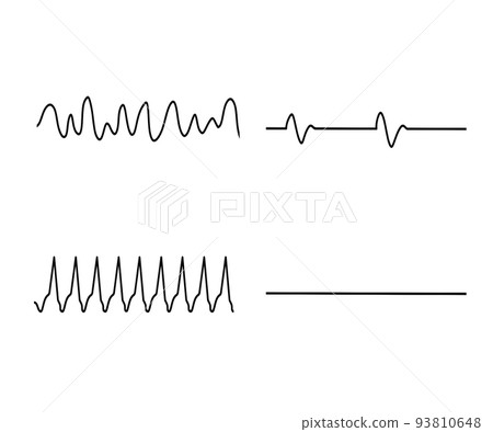 lethal arrhythmia 93810648