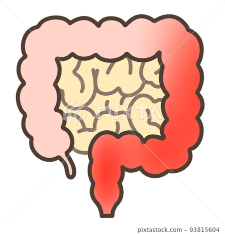 Ulcerative colitis - Stock Illustration [93815604] - PIXTA