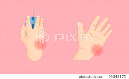rest your wrist. issue about working with mouse click longtime. beautiful color background. vector illustration eps10 rest your wrist. issue about working with mouse click longtime. beautiful color background. vector illustration eps10 93842175