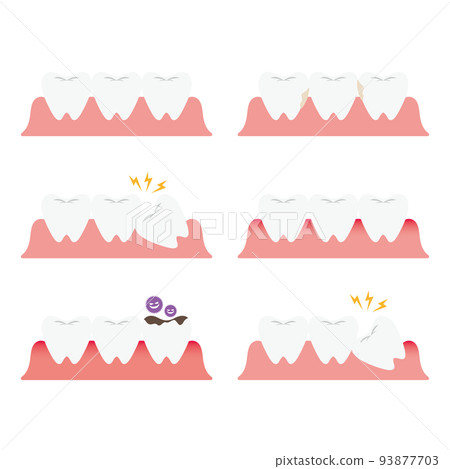 Tooth trouble illustration set Tooth trouble illustration set 93877703