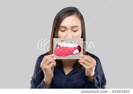 Aphthous Ulcers 93883905