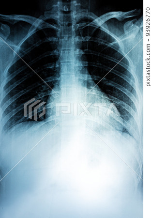 Film X-ray 93926770