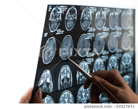 A female doctor examines an MRI scan of the brain. 93927655