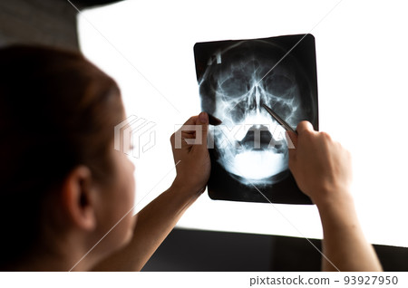 The doctor looks at the x-ray of the sinuses. The doctor looks at the x-ray of the sinuses. 93927950