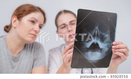 A woman doctor and a patient at the reception are discussing an x-ray of the sinuses. A woman doctor and a patient at the reception are discussing an x-ray of the sinuses. 93928558