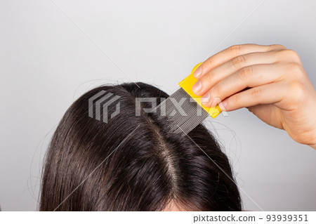 A brunette woman with pediculosis cleans her hair from lice and nits with a comb with small prongs. A lice comb. 93939351