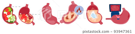 Sad sick cry and healthy strong happy smiling cute stomach character.Vector flat cartoon illustration icon.Isolated on white backgound.Stomach,stomachache, pain,sick,diarrhea ache,constipation concept Sad sick cry and healthy strong happy smiling cute stomach character.Vector flat cartoon illustration icon.Isolated on white backgound.Stomach,stomachache, pain,sick,diarrhea ache,constipation concept 93947361