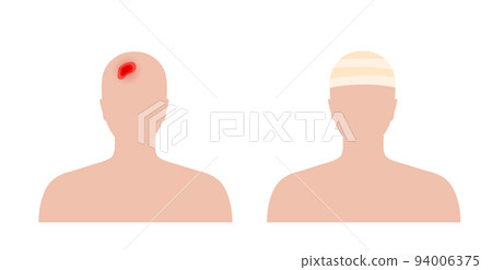 Human head trauma 94006375