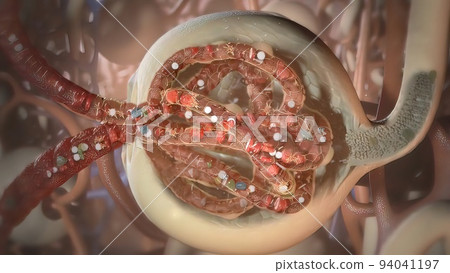 Procedure to remove clots from lungs 94041197