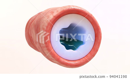 Bronchopulmonary segmental anatomy 94041198