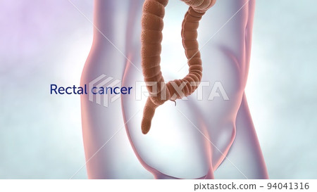 The large intestine includes the colon, rectum and anus. 94041316