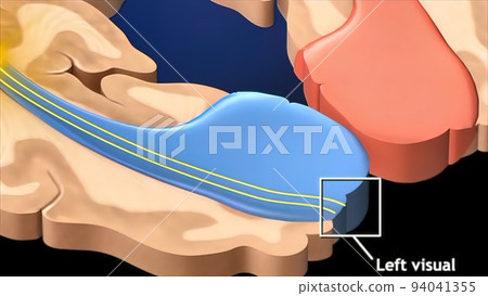 Medical 3D illustration of The Lateral Geniculate Nucleus Medical 3D illustration of The Lateral Geniculate Nucleus 94041355