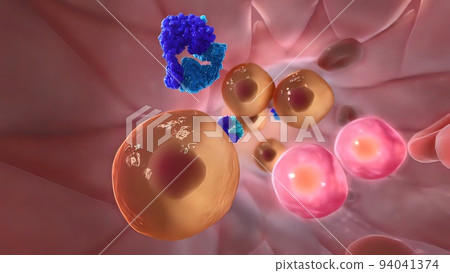 Metastasis for cancer that spreads to a different part of the body from where it Metastasis for cancer that spreads to a different part of the body from where it 94041374