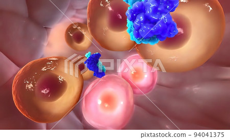 Metastasis for cancer that spreads to a different part of the body from where it 94041375